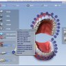 Planmeca PlanCAD Easy - Complete / Полная версия