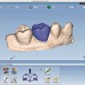 Planmeca PlanCAD Easy - Complete / Полная версия