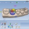 Planmeca PlanCAD Easy - Complete / Полная версия